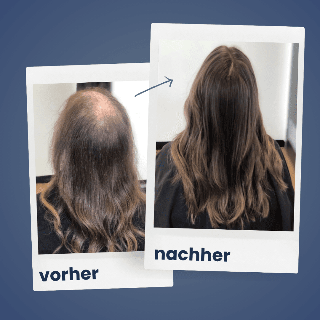 ShinyHair | repair kit