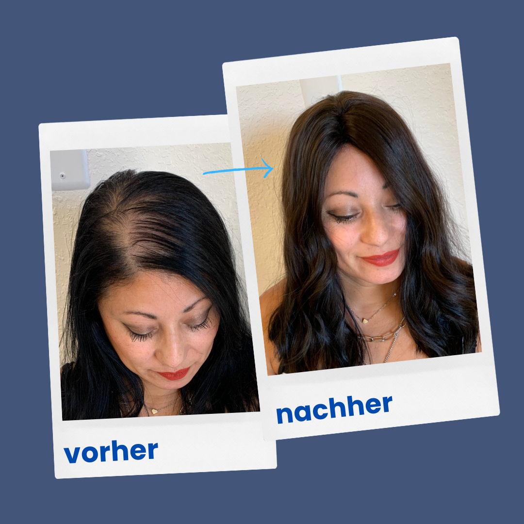 ShinyHair | Repair Kit