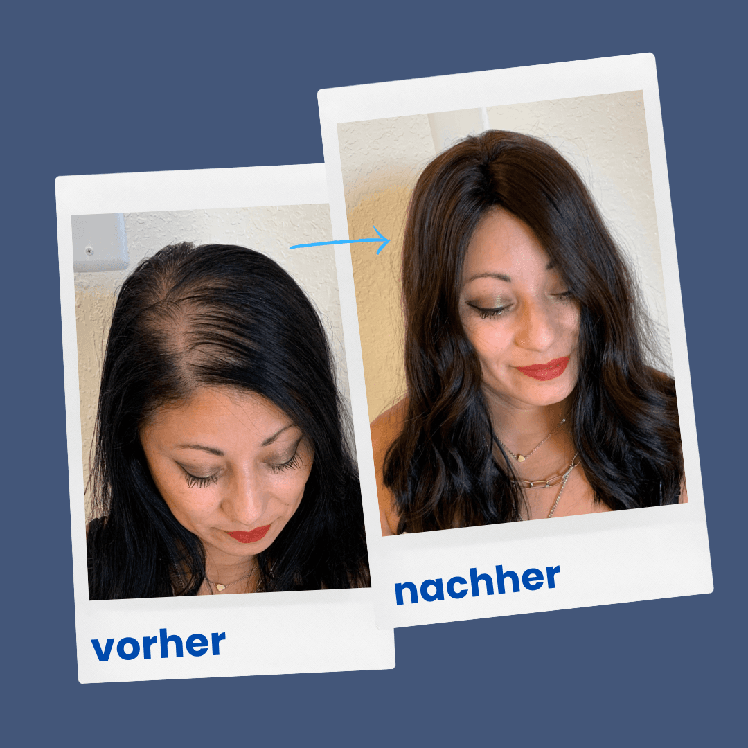 ShinyHair Haarwuchsbooster