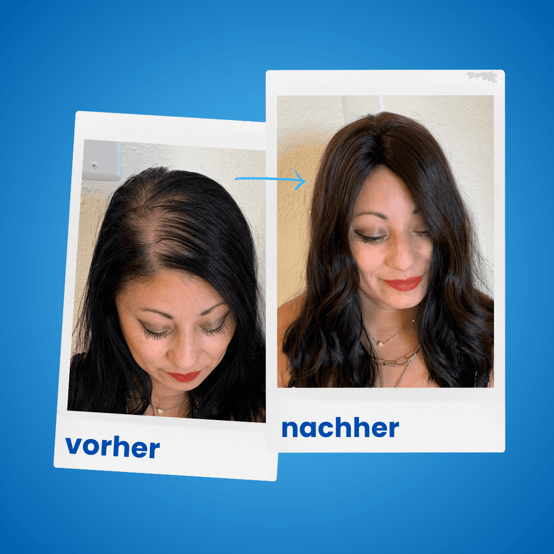 ShinyHair Haarwuchsbooster Sale