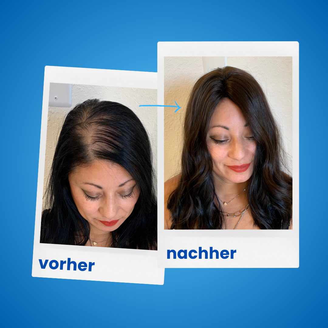 1x ShinyHair Haarwuchsbooster