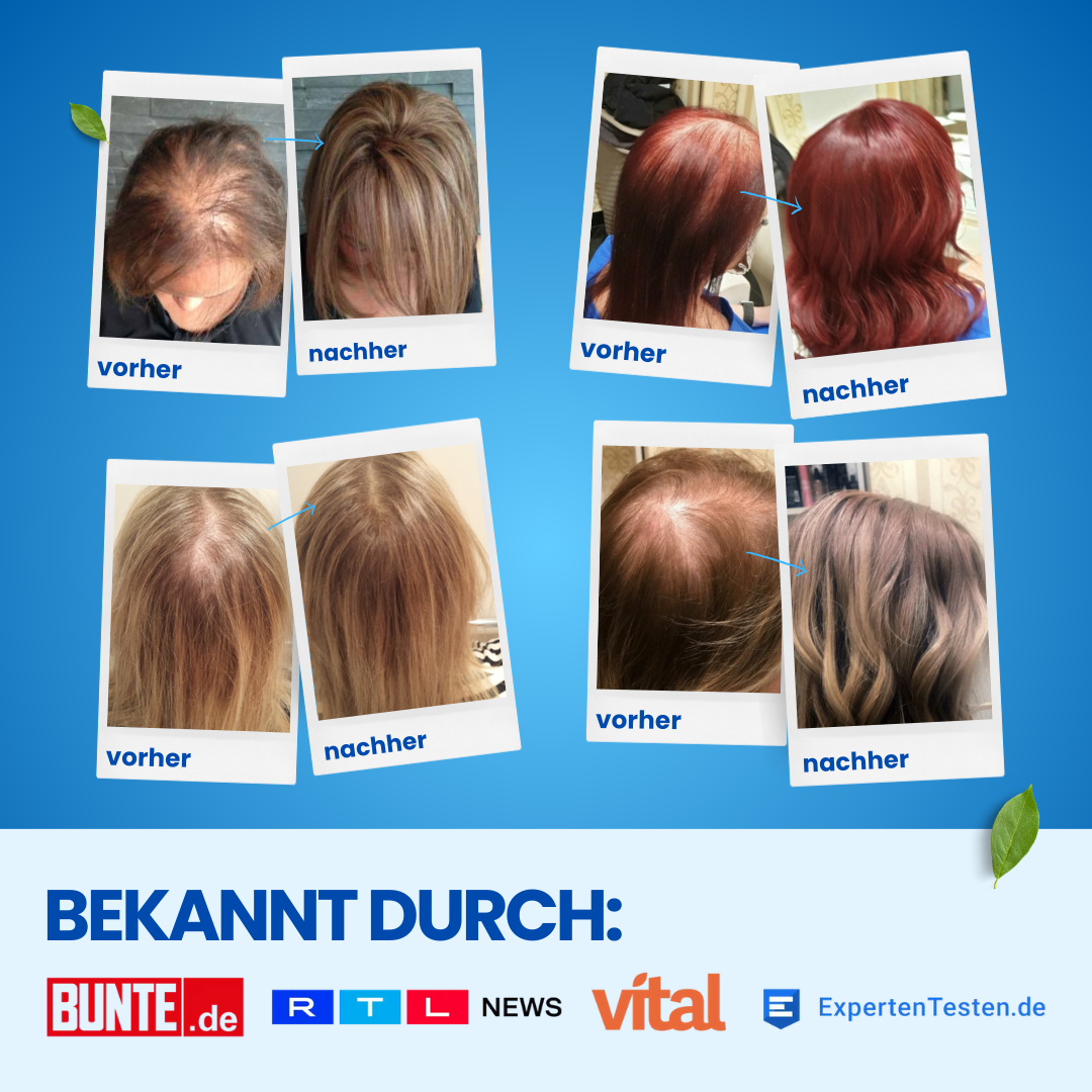 6x ShinyHair Haarwuchsbooster