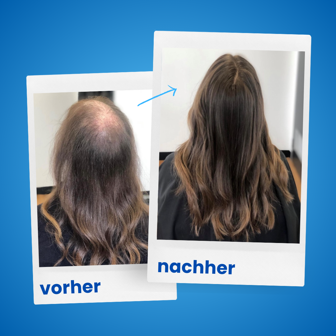 1x ShinyHair Haarwuchsbooster