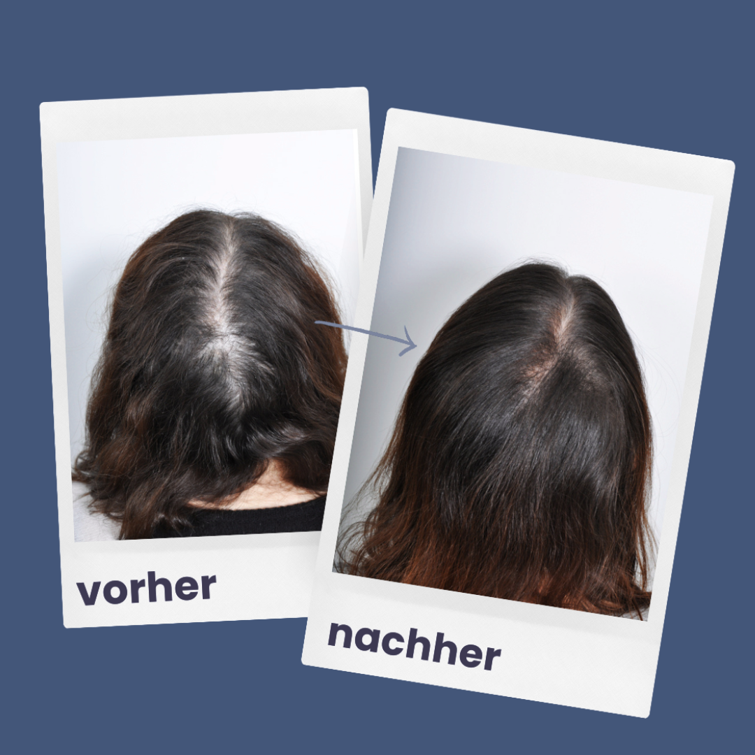 Glanzend Haar | reparatieset