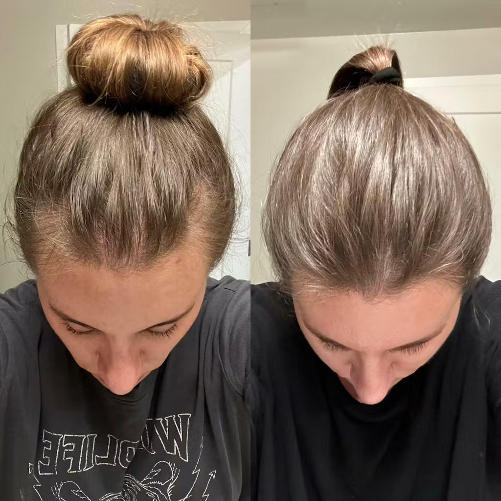 ShinyHair | Pflege Kit