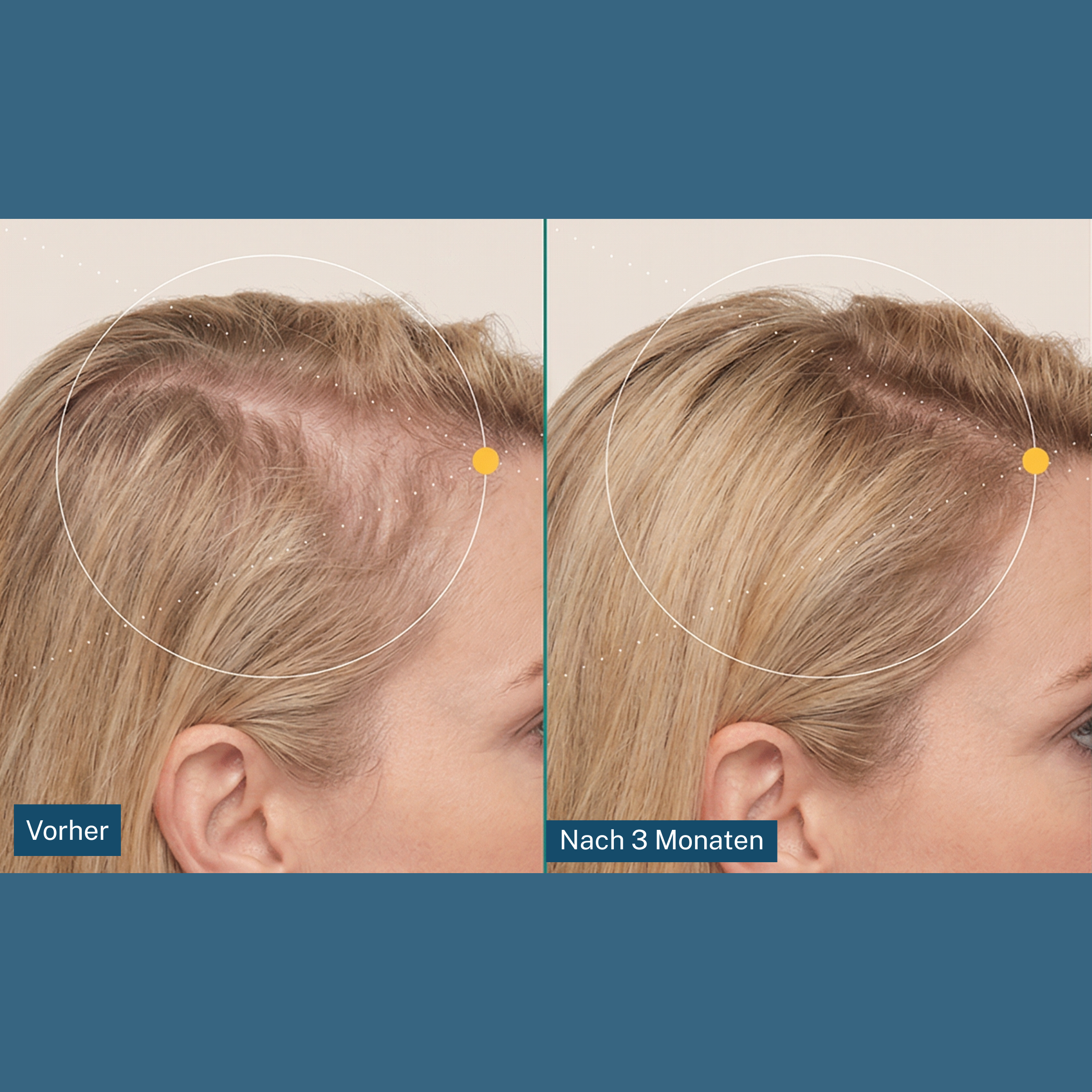 ShinyHair booster do wzrostu włosów